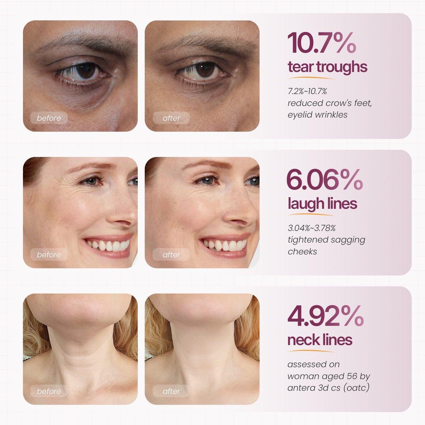 🏆 #1 Bestselling🏆Calcium Multi Balm | Anti-aging, Sagging, Wrinkles