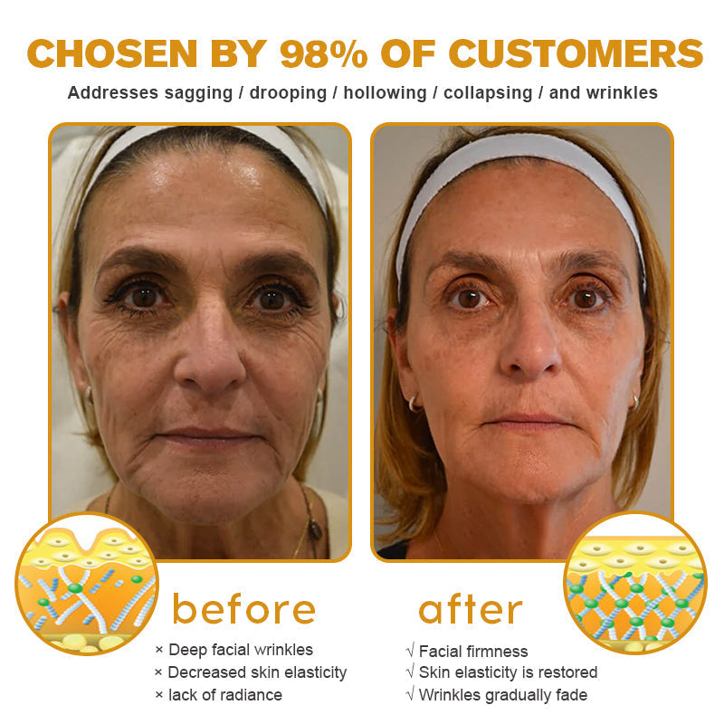 Botox Bee Venom Wrinkle Removal Cream TLOPA® (Extra 30% off on sale items!) - LAST DAY 70% OFF🎁