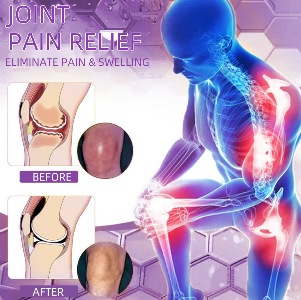 Official Store: TLOPA® Shark Cartilage Pain-Soothing Bone Recovery Gel👨‍⚕️Approved by MHRA (5-minute pain relief, 7 days to restore joint mobility, 4 weeks for complete healing) 🔥