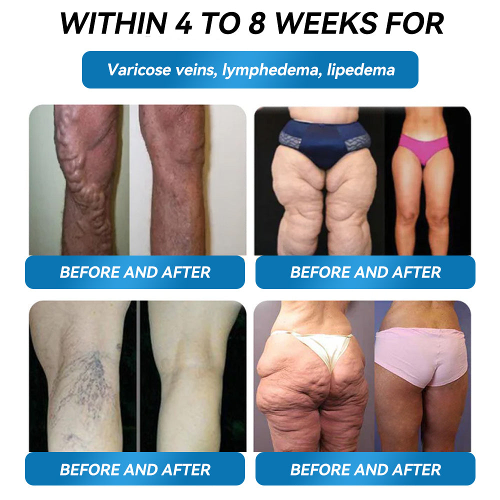 𝐎𝐟𝐟𝐢𝐜𝐢𝐚𝐥 𝐔𝐊 𝐂𝐞𝐫𝐭𝐢𝐟𝐢𝐞𝐝👨‍⚕️ 𝐅𝐥𝐚𝐠𝐬𝐡𝐢𝐩 𝐒𝐭𝐨𝐫𝐞 𝐃𝐢𝐫𝐞𝐜𝐭 𝐒𝐚𝐥𝐞𝐬||💎 𝐋𝙀𝑹𝐂𝑬𝗔® 𝐆𝙇𝐏-𝟏 𝑴𝒆𝒕𝒂𝒃𝒐𝒍𝒊𝒄 𝑩𝒂𝒍𝒂𝒏𝒄𝒆 𝑶𝒓𝒂𝒍 𝑨𝒎𝒑𝒐𝒖𝒍𝒆𝒔: 𝐒𝐮𝐢𝐭𝐚𝐛𝐥𝐞 𝐟𝐨𝐫 𝐨𝐛𝐞𝐬𝐢𝐭𝐲, 𝐜𝐚𝐫𝐝𝐢𝐨𝐯𝐚𝐬𝐜𝐮𝐥𝐚𝐫 𝐝𝐢𝐬𝐞𝐚𝐬𝐞𝐬, 𝐝𝐢𝐚𝐛𝐞𝐭𝐞𝐬, 𝐬𝐥𝐞𝐞𝐩 𝐚𝐩𝐧𝐞𝐚 𝐬𝐲𝐧𝐝𝐫𝐨𝐦𝐞, 𝐣𝐨𝐢𝐧𝐭 𝐢𝐬𝐬𝐮𝐞𝐬, 𝐚𝐧𝐝 𝐦𝐨𝐫𝐞 💎