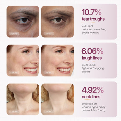 🏆 #1 Bestselling🏆Calcium Multi Balm | Anti-aging, Sagging, Wrinkles