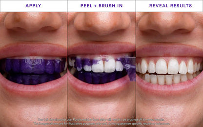 Whitening Strips: ‘’The Fast Track to a Stunning Smile!‘’