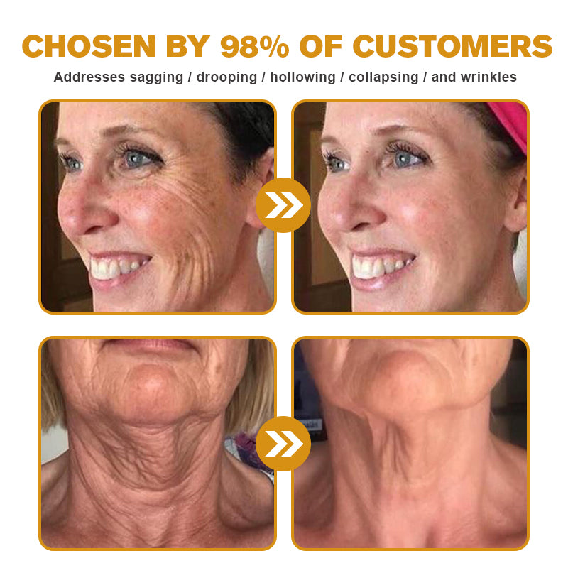 Botox Bee Venom Wrinkle Removal Cream TLOPA®  (Extra 30% off on sale items!) - LAST DAY 70% OFF🎁