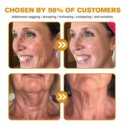 Botox Bee Venom Wrinkle Removal Cream TLOPA®  (Extra 30% off on sale items!) - LAST DAY 70% OFF🎁