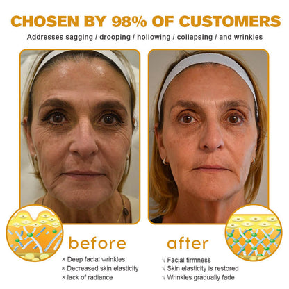 Botox Bee Venom Wrinkle Removal Cream TLOPA®  (Extra 30% off on sale items!) - LAST DAY 70% OFF🎁